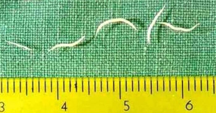 Pinworms არის ყველაზე გავრცელებული ტიპის ჭია მცირეწლოვან ბავშვებში. 