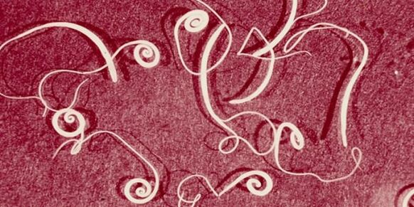 ადამიანის პარაზიტების ფოტო