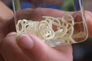 პარაზიტები ადამიანის ორგანიზმიდან