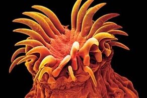 ტრემატოდური პარაზიტები ადამიანებში