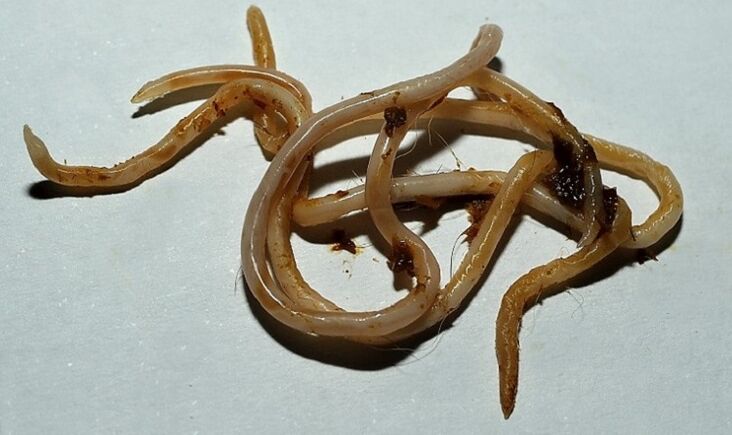 ტოქსოკარა ადამიანის ორგანიზმიდან